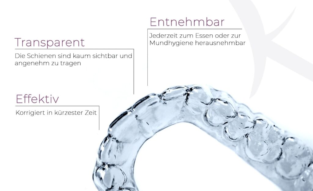 Vorteile von K-Clear, transparente Zahnschiene