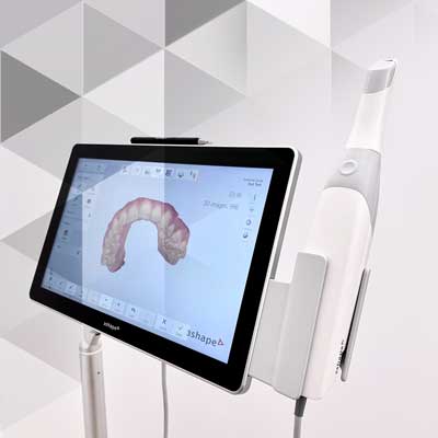 Digitale Abformung – Intraoralscanner (3D-Scan)